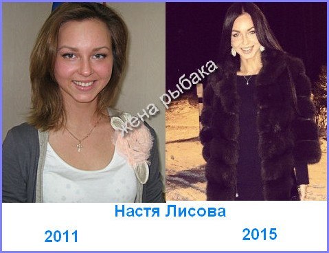 Как выглядит ноготь руки пораженный грибком фото Как выглядит ноготь руки пораженный грибком фото